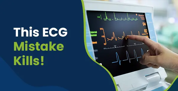 A Guide to Understanding ECG Artifacts post img