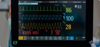 PEA (Pulseless Electrical Activity)