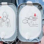 AED Pad Placement FAQ post img