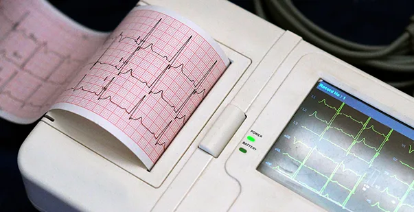 The Ultimate 12-Lead ECG Placement Guide post img