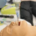 How to Master Tracheal Intubation post img