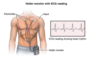 Holter monitor with ECG readings 