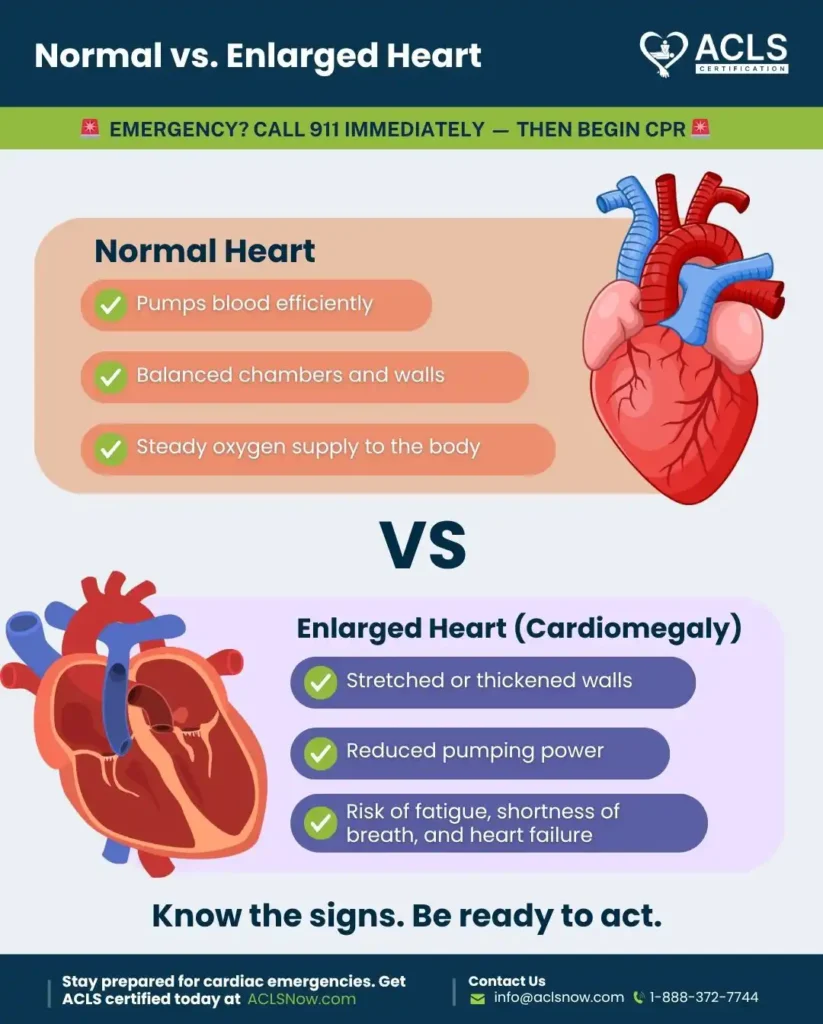 Enlarged heart (Cardiomegaly) 