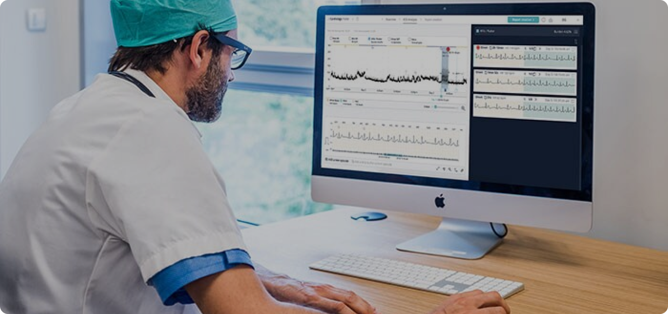 Ventricular Tachycardia Practice Paper