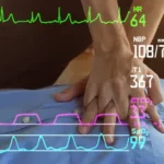 What is the Main Determinant of EtCO2 During CPR post img