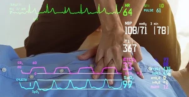 What is the Main Determinant of EtCO2 During CPR post img