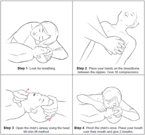 Steps to Perform Rescue Breathing